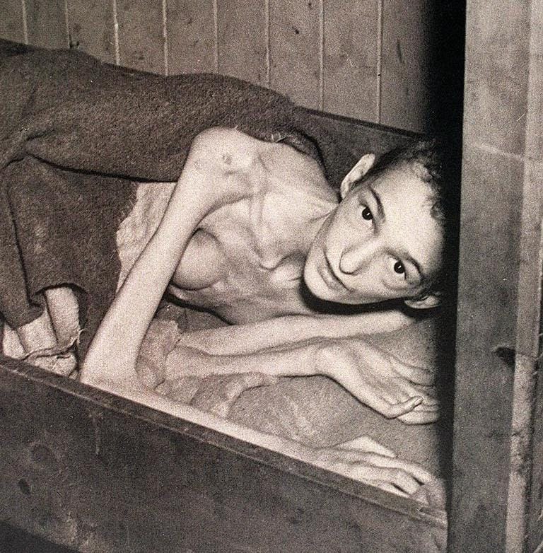 Nazi Concentration Camp Survivor Nazi Concentration Camp Survivor
